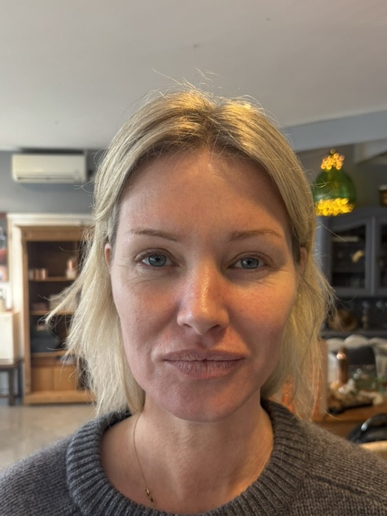 Sharon after - face