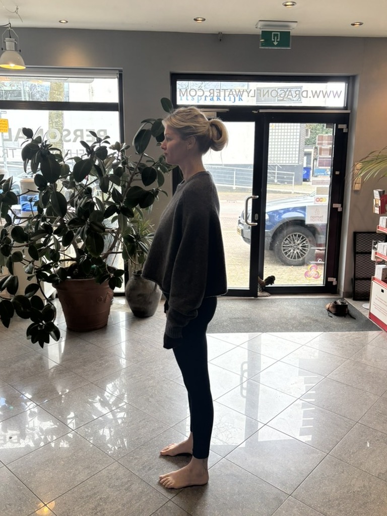 Sharon before - posture